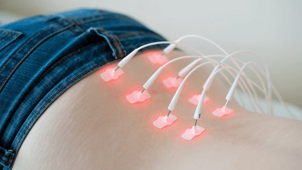 Châm cứu giúp cân bằng âm dương