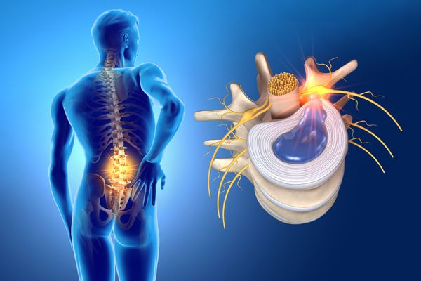 Bấm huyệt điều trị thoát vị đĩa đệm được thực hiện tại trung tâm trị liệu uy tín