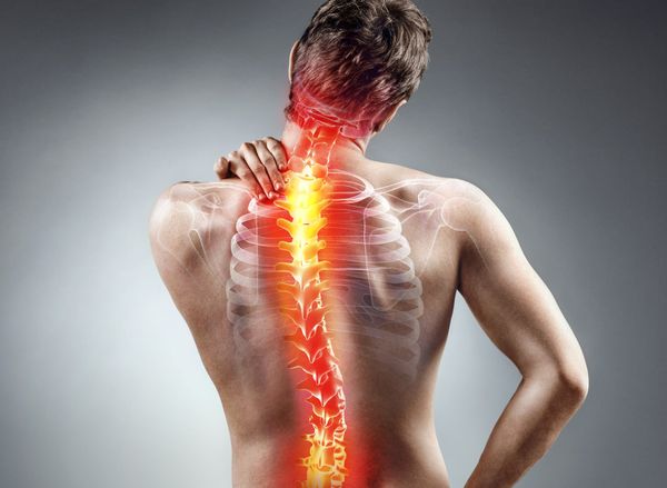 Hình ảnh minh họa cấu trúc cột sống thắt lưng bị tổn thương