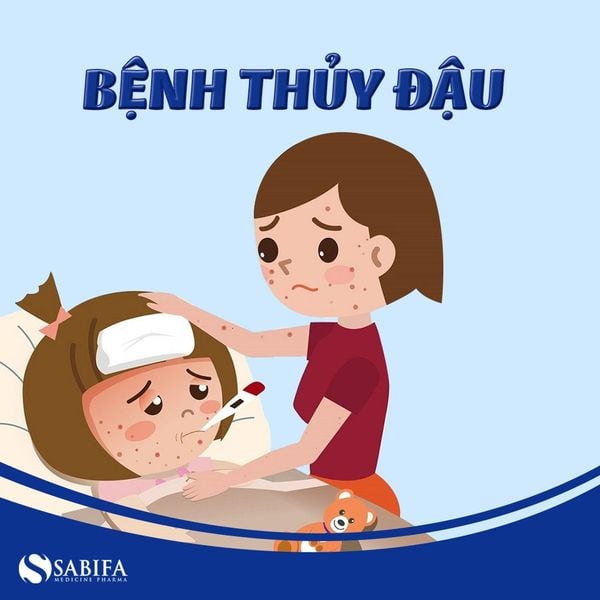 Thủy đậu là bệnh thường gặp ở trẻ nhỏ khi giao mùa xuân - hè