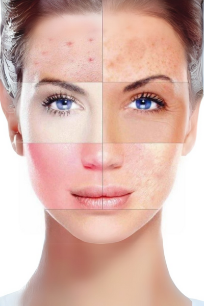 Vì sao dùng nhiều loại viên uống trắng da nhưng không hết sạm nám, nếp nhăn ?