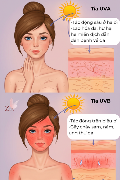 Hết sạm nám: Hướng dẫn chi tiết từ A-Z