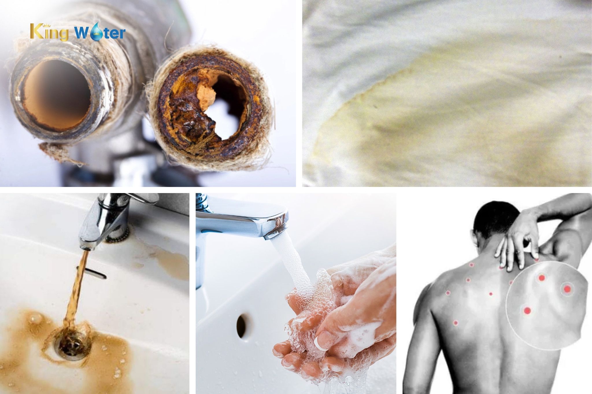 Tác hại của nước cứng trong quá trình sinh hoạt hằng ngày
