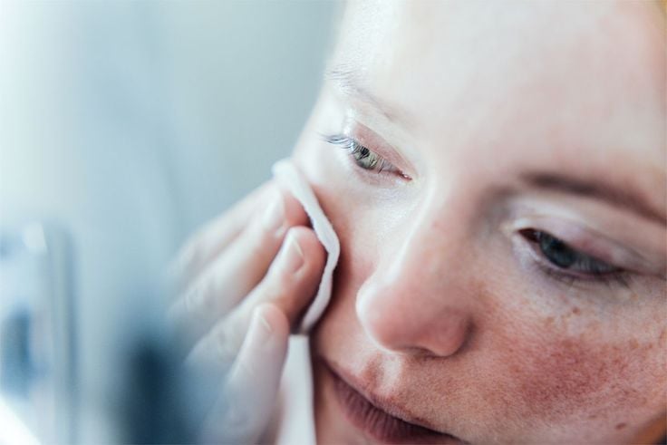 Da không đều màu: Hiểu đúng để cải thiện bền vững