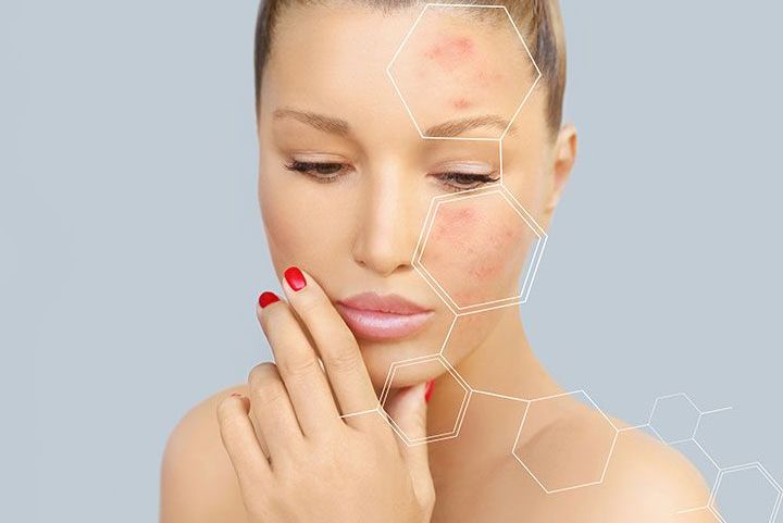 Các kiểu tổn thương hàng rào da và cách phục hồi đúng