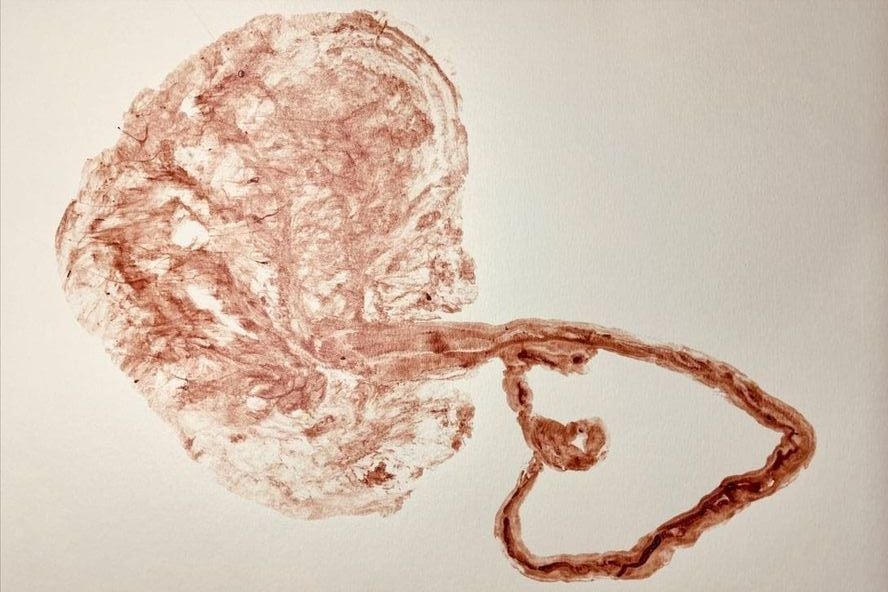 Bio Placenta: phức hợp 5 loại Peptide – Tế Bào Gốc Sinh Học, siêu phục hồi, tái tạo, chống lão hóa