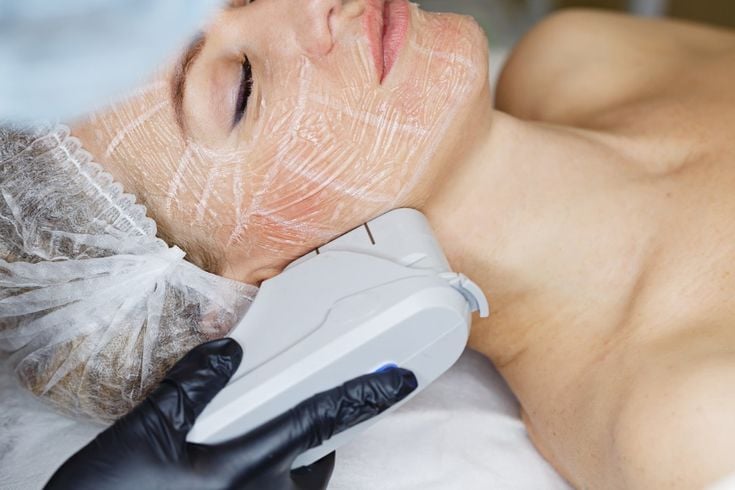 Công nghệ Ultherapy: Nâng cơ, trẻ hóa da không phẫu thuật