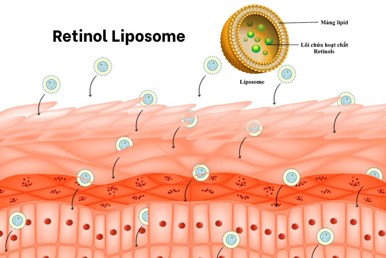 Retinol bọc liposome Thụy Sĩ - không kích ứng, chống lão hóa và tăng sinh collagen mạnh mẽ