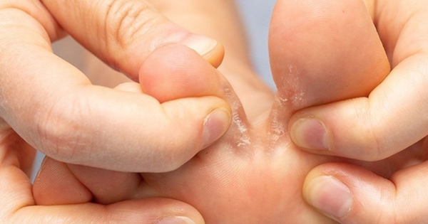 chon tat di giay the thao sai de gay nam chan