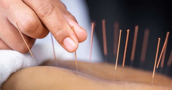 So sánh y học cổ truyền và y học hiện đại
