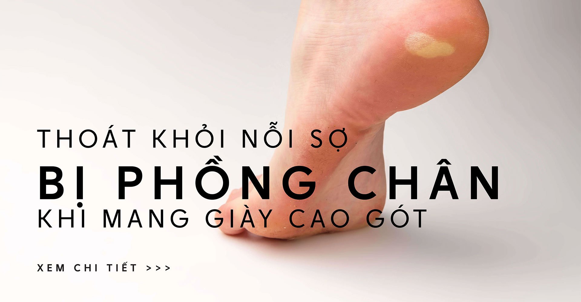 Thoát khỏi nỗi sợ bị phồng chân khi mang giày cao gót