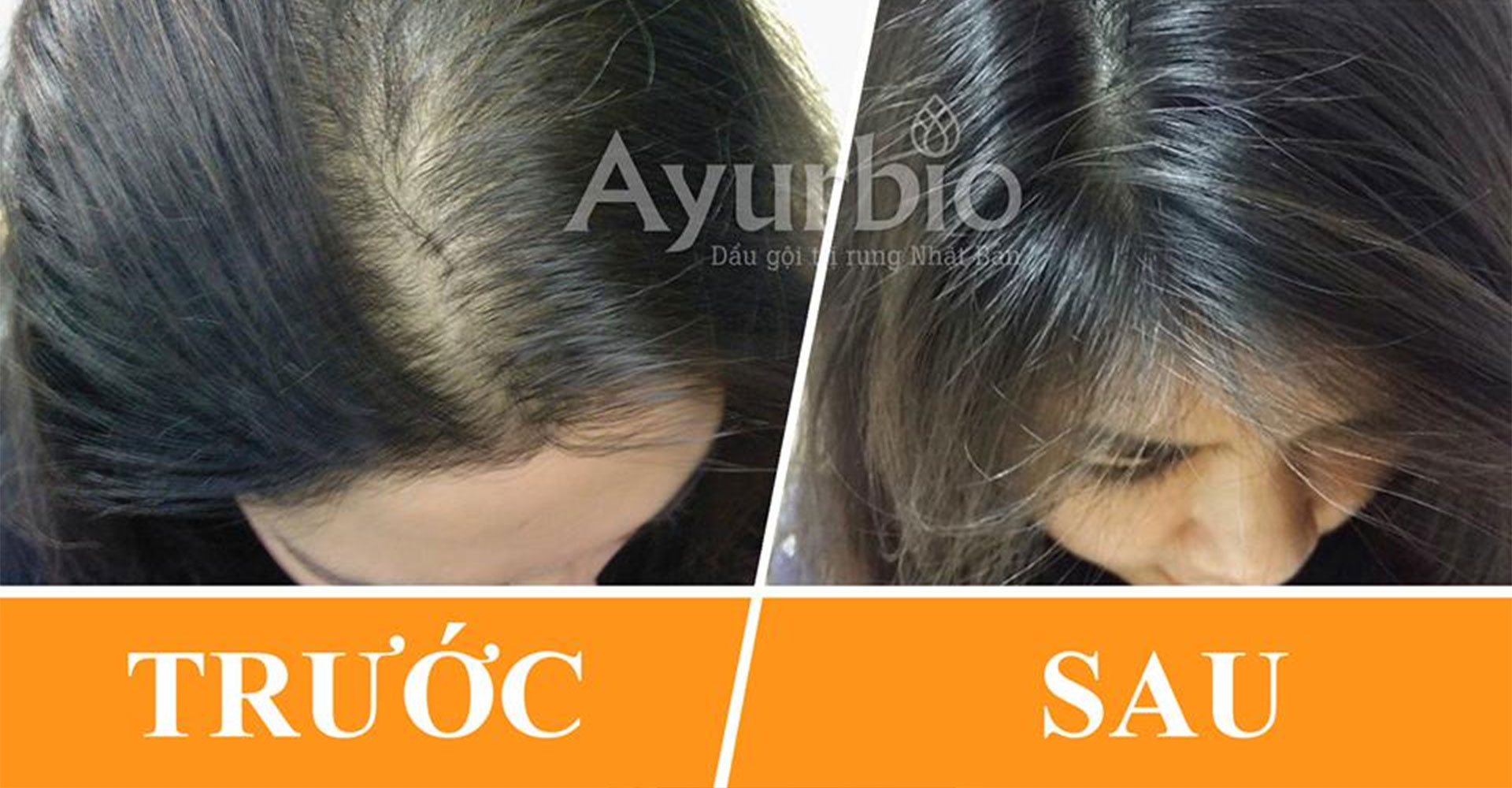 Vì sao dầu gội ayurbio mang công dụng trị rụng tóc hiệu quả