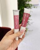 𝐓𝐑𝐄𝐓𝐈𝐍𝐎𝐈𝐍 𝐀𝐂𝐍𝐄𝐋𝐘𝐒𝐄 - Tre Thổ Nhỉ Kỳ 🙂