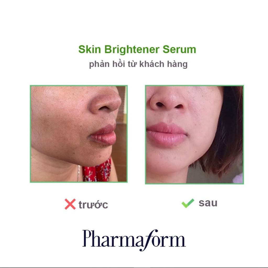 Giải mã Pharmaform Skin Brightener - serum trắng da, giảm thâm nám chỉ sau 4 tuần