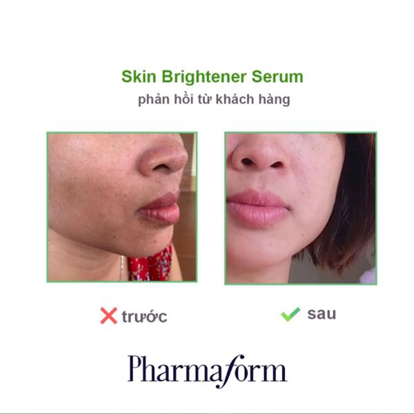 Giải mã Pharmaform Skin Brightener - serum trắng da, giảm thâm nám chỉ sau 4 tuần