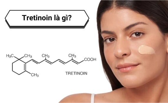 Tretinoin: Tác Dụng, Lợi Ích Cho Da & Cách Dùng