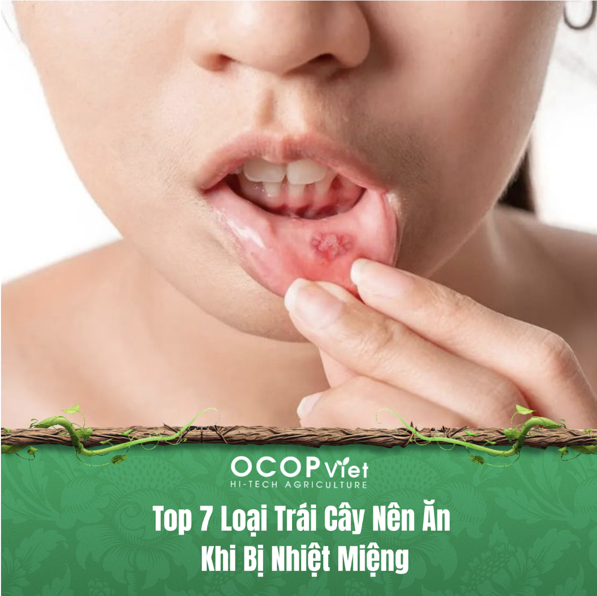 Top 7 Loại Trái Cây Nên Ăn Khi Bị Nhiệt Miệng