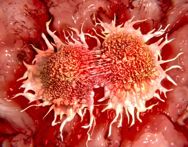 3 Cơ Chế Giúp Tế Bào Ung Thư Trốn Tránh Hệ Miễn Dịch