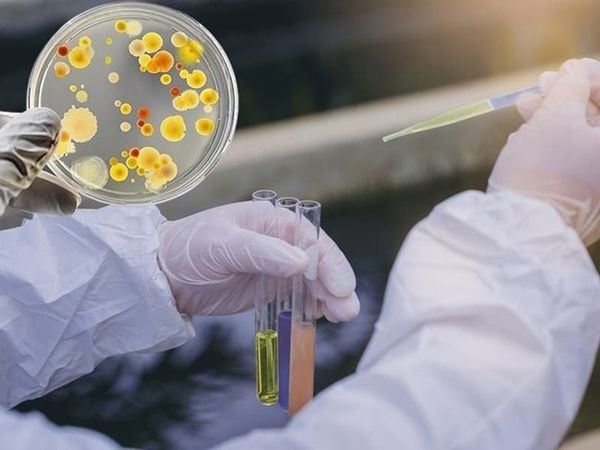 Vi sinh vật xử lý nước thải là các sinh vật cực nhỏ