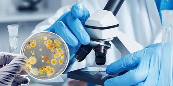 Chế phẩm vi sinh xử lý nước thải có tác dụng gì?