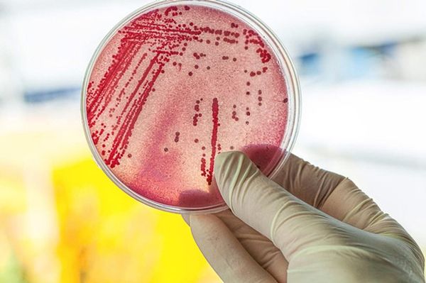 Tác động của Coliform trong nước thải