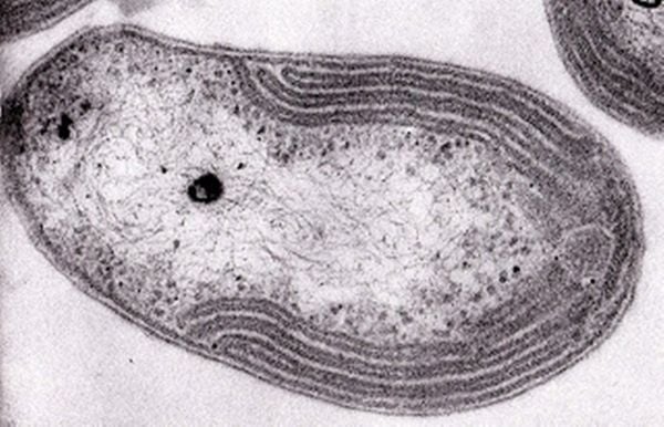 Vi khuẩn Nitrosomonas
