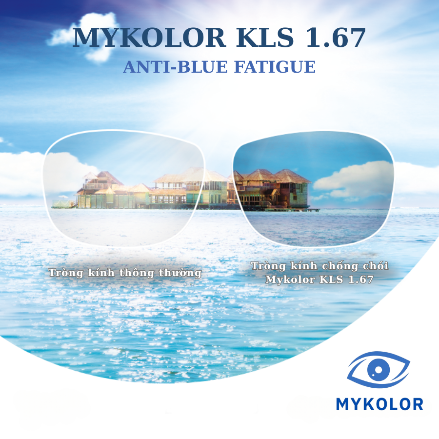 Giải pháp hoàn hảo cho team cận đi biển – Không đổi màu, không kính râm, vẫn chống chói hiệu quả!