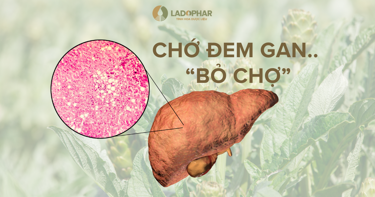 Chớ Đem… GAN Bỏ Chợ! – Giải Pháp Giải Độc Gan Từ Actiso