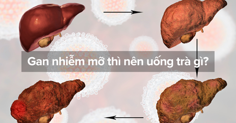 Gan nhiễm mỡ thì nên uống trà gì?