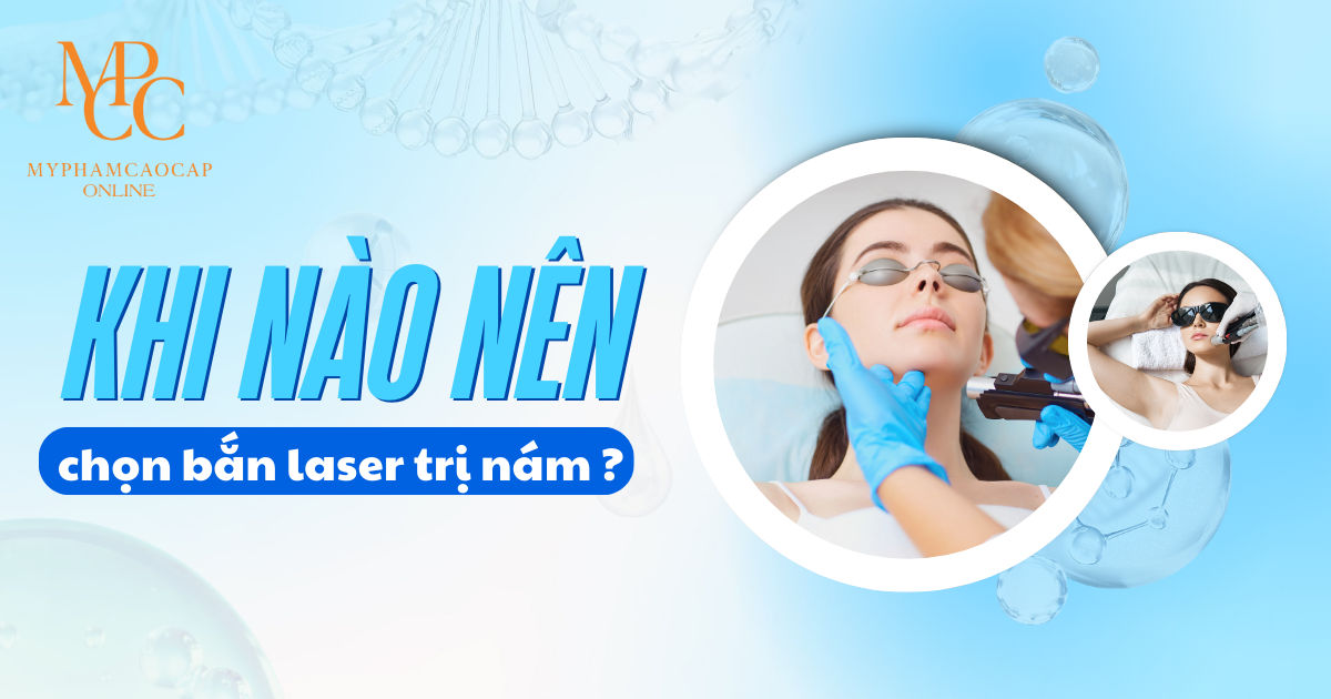 Khi nào nên chọn bắn laser trị nám?