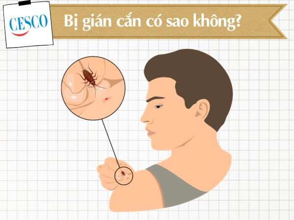 Bị gián cắn có sao không? Hên hay xui