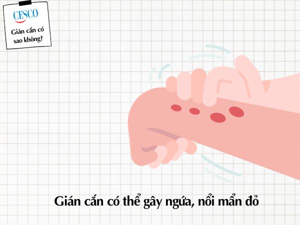 gián có cắn không, bị gián cắn có sao không, gián cắn gây ngứa, nổi mẩn