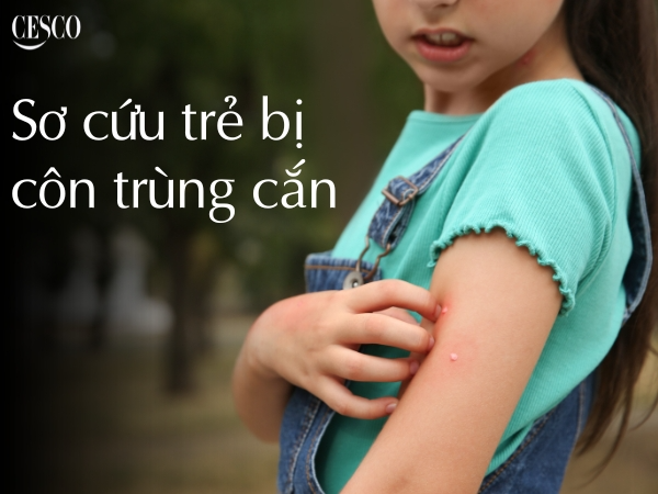 sơ cứu trẻ bị côn trùng cắn như thế nào? khi bi côn trùng cắn phải làm sao