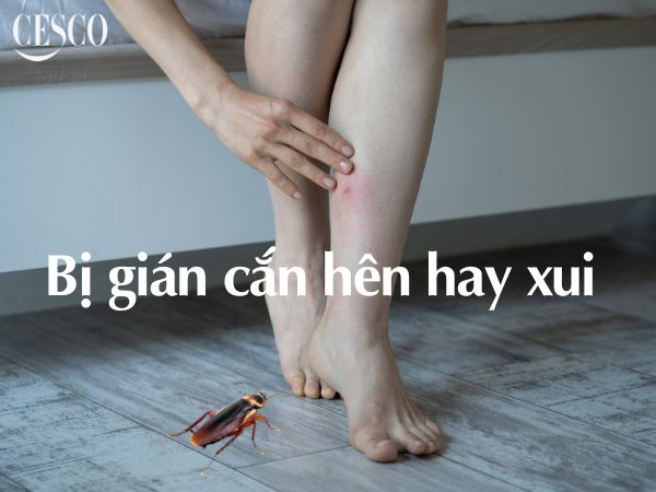 bị gián cắn có sao không, hên hay xui vậy cesco