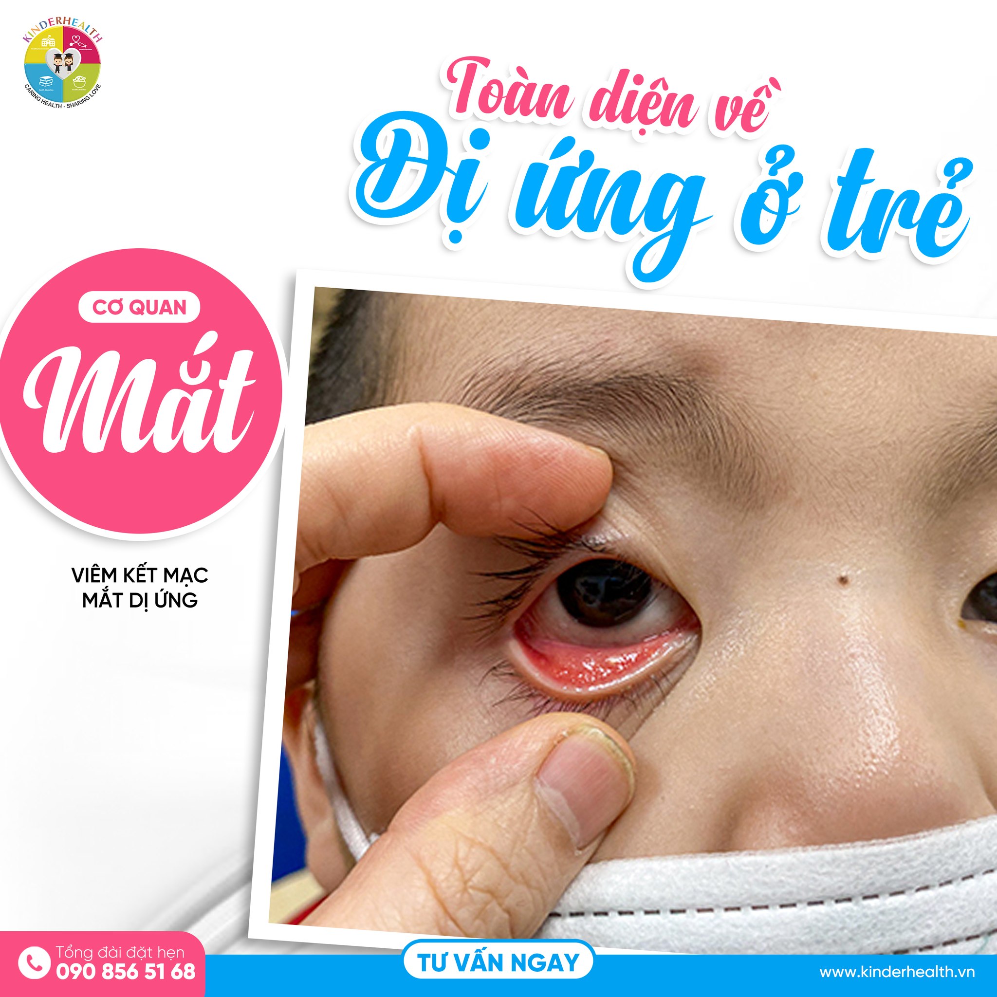 BÉ HAY DỤI MẮT, MẸ COI CHỪNG VIÊM KẾT MẠC MẮT DỊ ỨNG