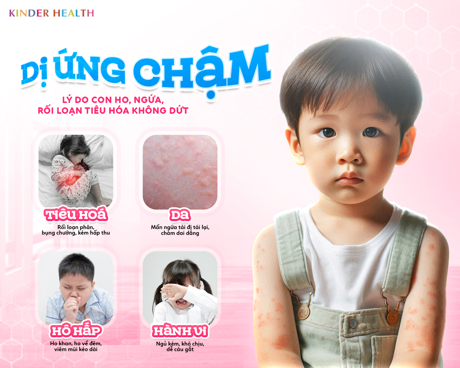 DỊ ỨNG CHẬM - LÝ DO CON HO, NGỨA, RỐI LOẠN TIÊU HÓA KHÔNG DỨT
