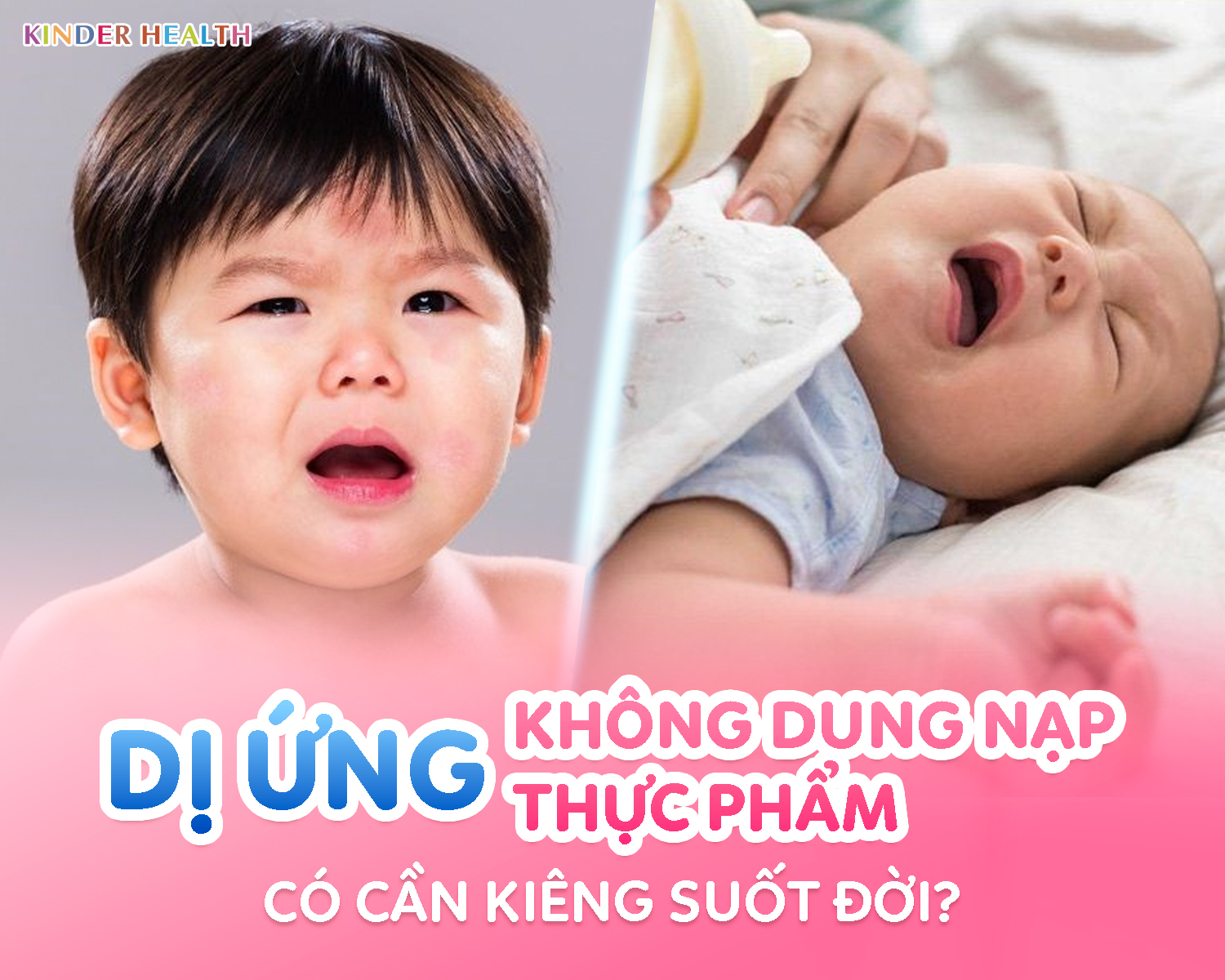 DỊ ỨNG/KHÔNG DUNG NẠP THỰC PHẨM CÓ CẦN KIÊNG SUỐT ĐỜI?