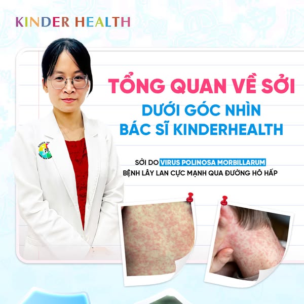 Tổng quan về sởi dưới góc nhìn của Bác sĩ Kinder health