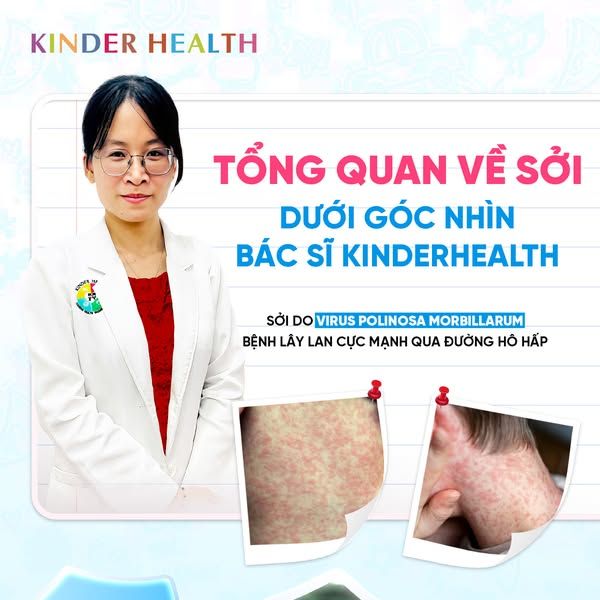 Tổng quan về sởi dưới góc nhìn của Bác sĩ Kinder health