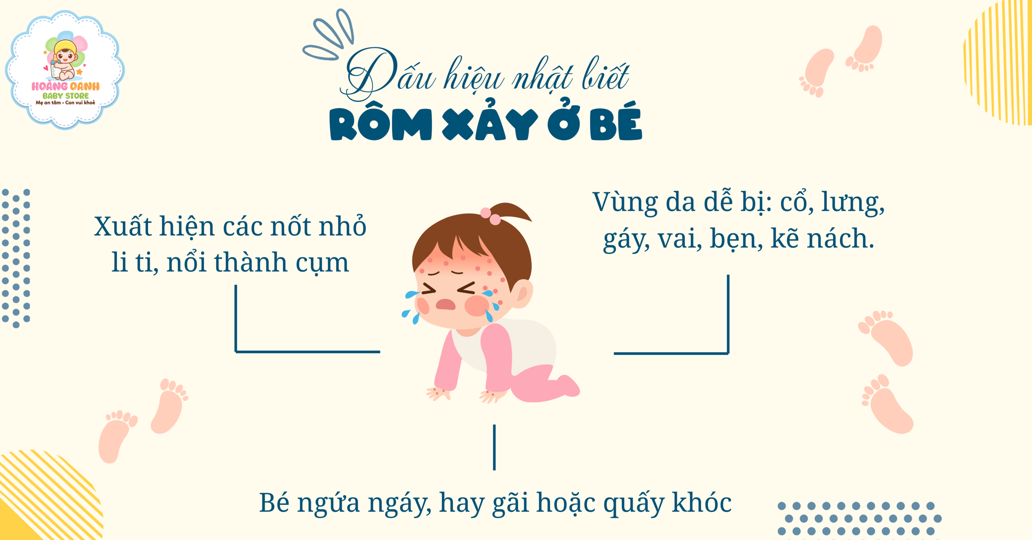 CÁCH LÀM DỊU DA KHI BÉ BỊ RÔM XẢY