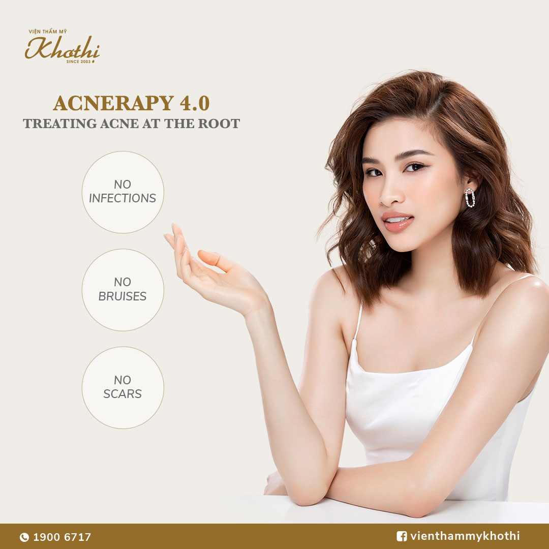 ACNE TREATMENT WITH ACNERAPY 4.0