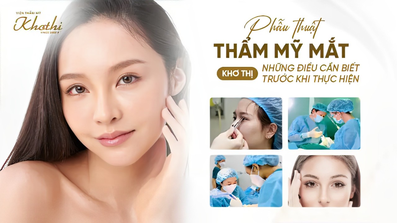 Phẫu thuật thẩm mỹ mắt Khơ Thị – Những điều cần biết trước khi thực hiện