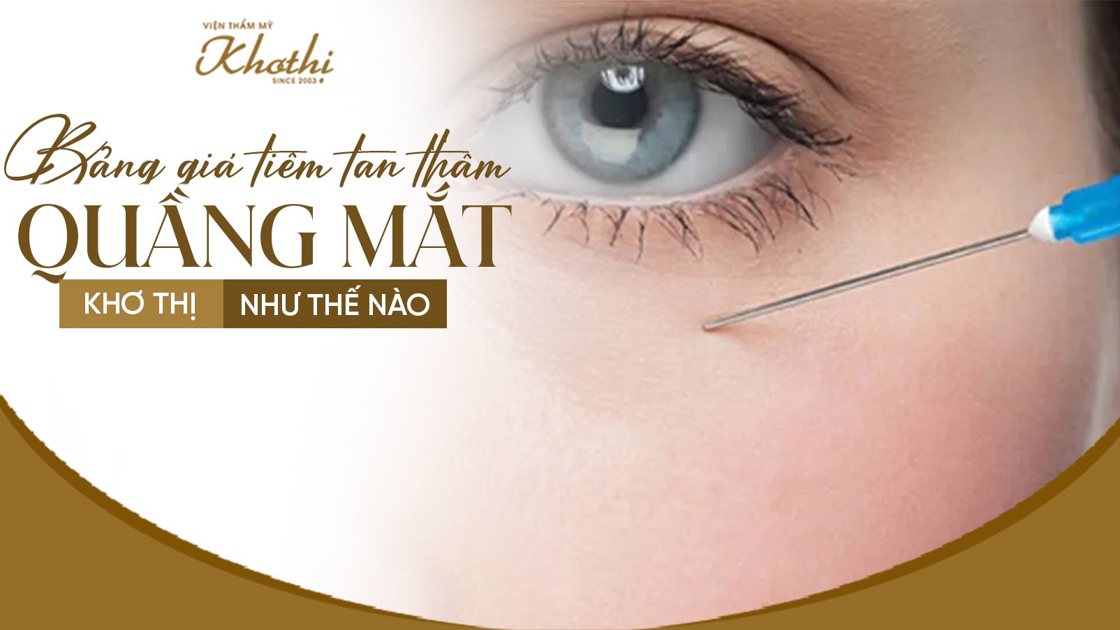 Bảng giá tiêm tan thâm quầng mắt Khơ Thị như thế nào? Có nên thực hiện không?