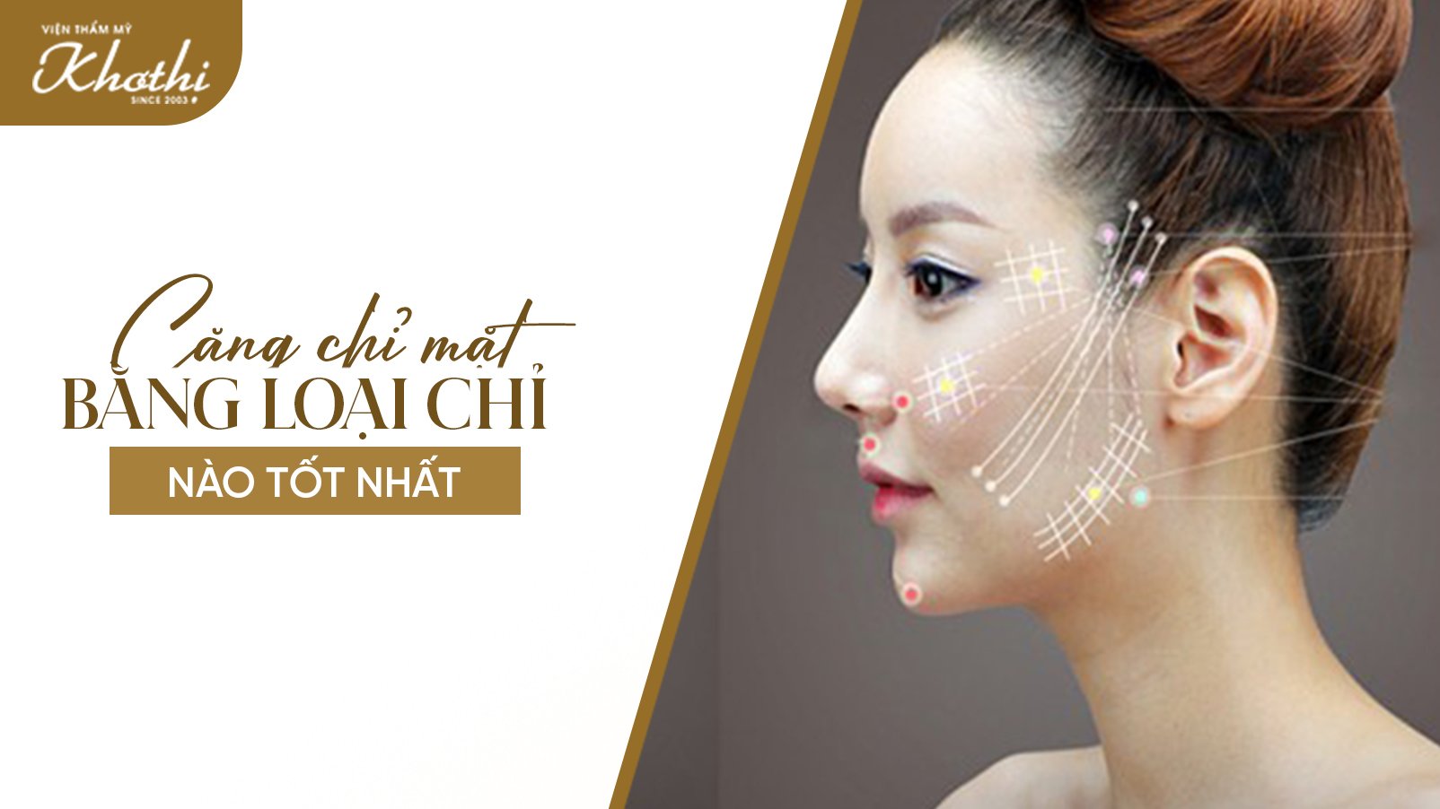 Căng chỉ mặt bằng loại chỉ nào tốt nhất? So sánh chỉ tự tiêu và chỉ không tiêu