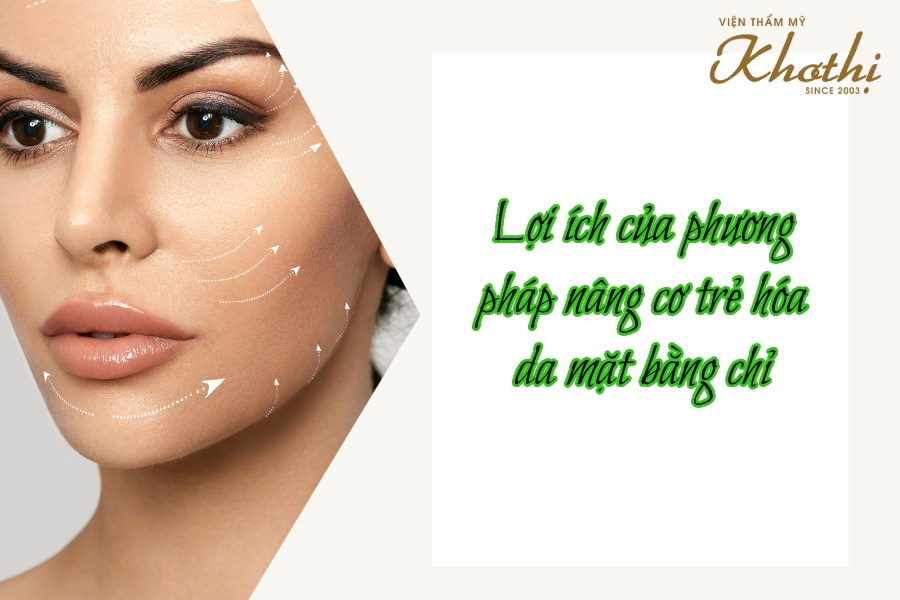 Căng chỉ nâng cơ – Giải pháp hiệu quả và lâu dài cho làn da chảy xệ