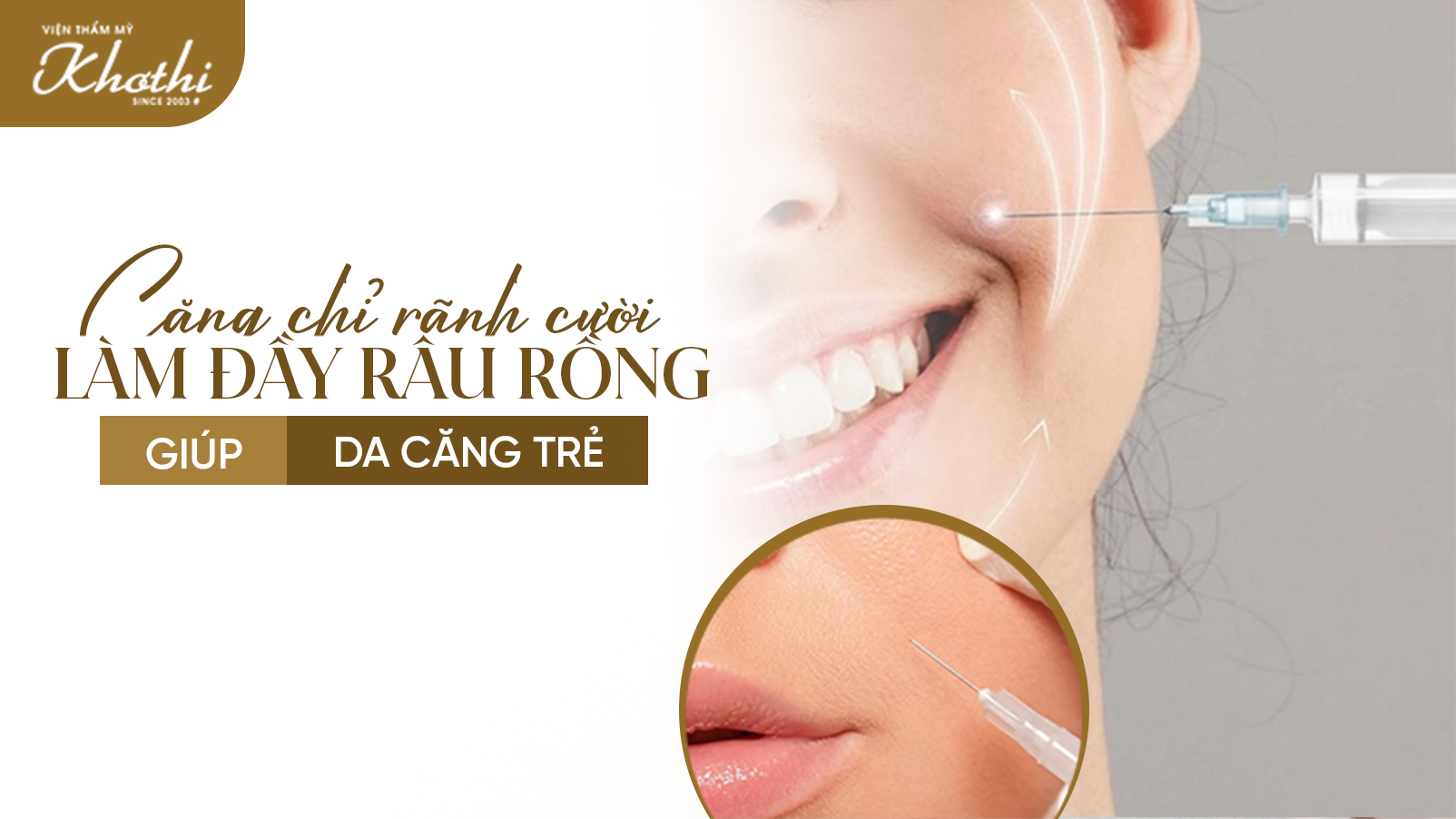 Căng chỉ rãnh cười làm đầy râu rồng giúp da căng trẻ