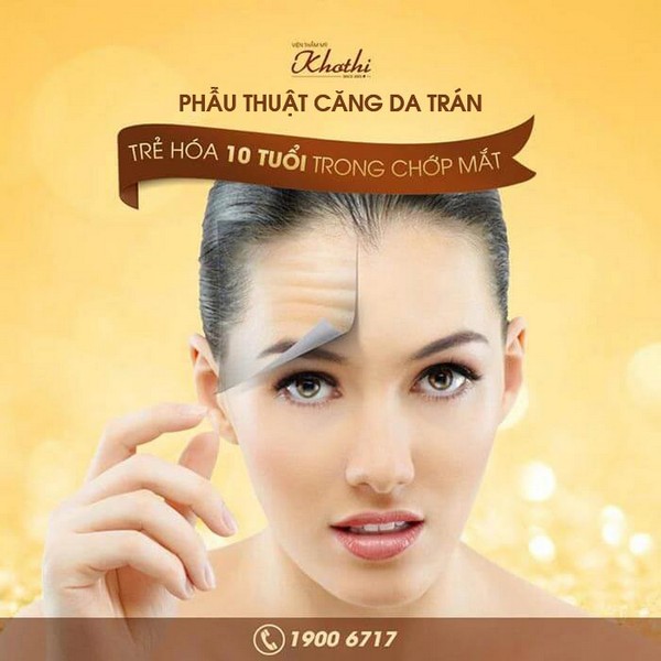 Phẫu thuật căng da trán và căng da trán thái dương