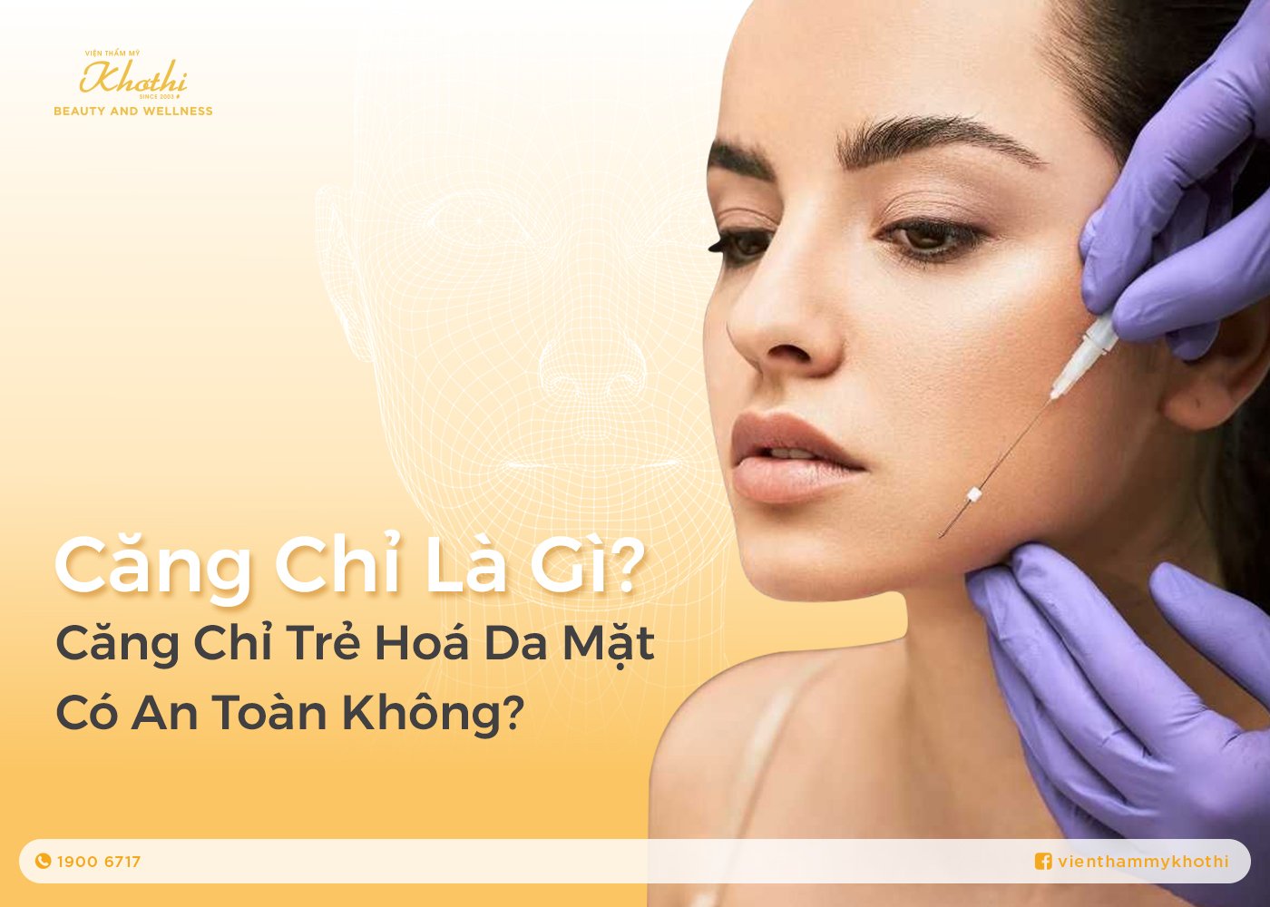 Căng Chỉ Là Gì? Căng Chỉ Collagen Trẻ Hoá Có An Toàn Không?