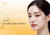 Căng Chỉ Mắt Cáo Là Gì? Có Nên Căng Chỉ Fox Eyes Không?
