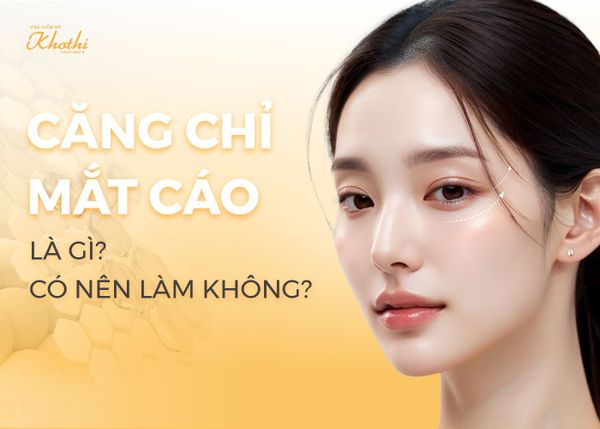 Căng Chỉ Mắt Cáo Là Gì? Có Nên Căng Chỉ Fox Eyes Không?